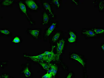 Immunocytochemistry/ Immunofluorescence - Anti-DDX6 antibody (AB234837)