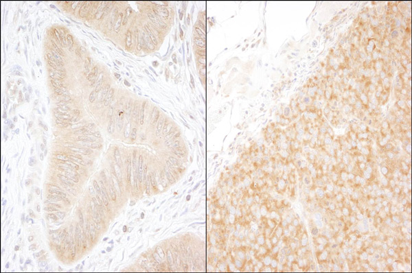 Immunohistochemistry (Formalin/PFA-fixed paraffin-embedded sections) - Anti-DDX6 antibody (AB70455)