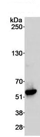 Immunoprecipitation - Anti-DDX6 antibody (AB70455)