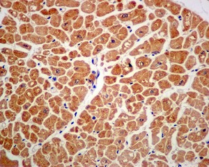 Immunohistochemistry (Formalin/PFA-fixed paraffin-embedded sections) - Anti-DDX6 antibody [EPR12146] (AB174277)