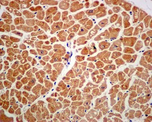 Immunohistochemistry (Formalin/PFA-fixed paraffin-embedded sections) - Anti-DDX6 antibody [EPR12146] - BSA and Azide free (AB249788)