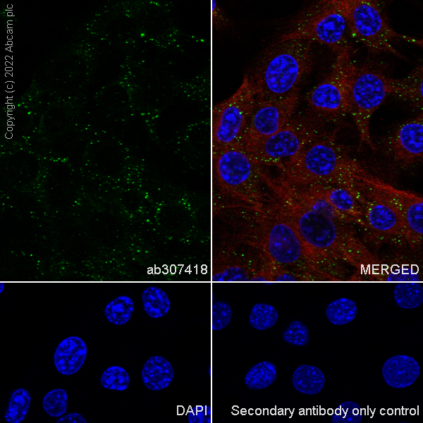 Immunocytochemistry/ Immunofluorescence - Anti-DDX6 antibody [EPR27016-10] (ab307418), expandable thumbnail