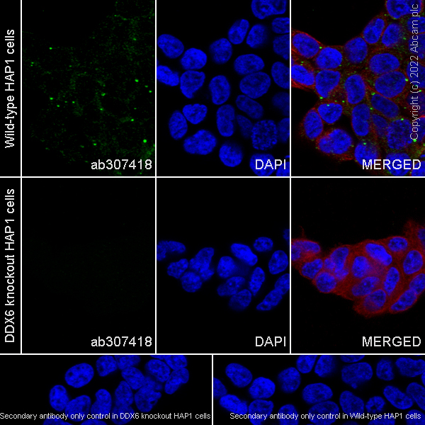 Immunocytochemistry/ Immunofluorescence - Anti-DDX6 antibody [EPR27016-10] (ab307418), expandable thumbnail