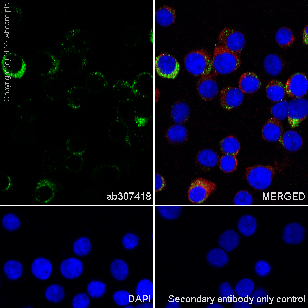 Immunocytochemistry/ Immunofluorescence - Anti-DDX6 antibody [EPR27016-10] (ab307418), expandable thumbnail