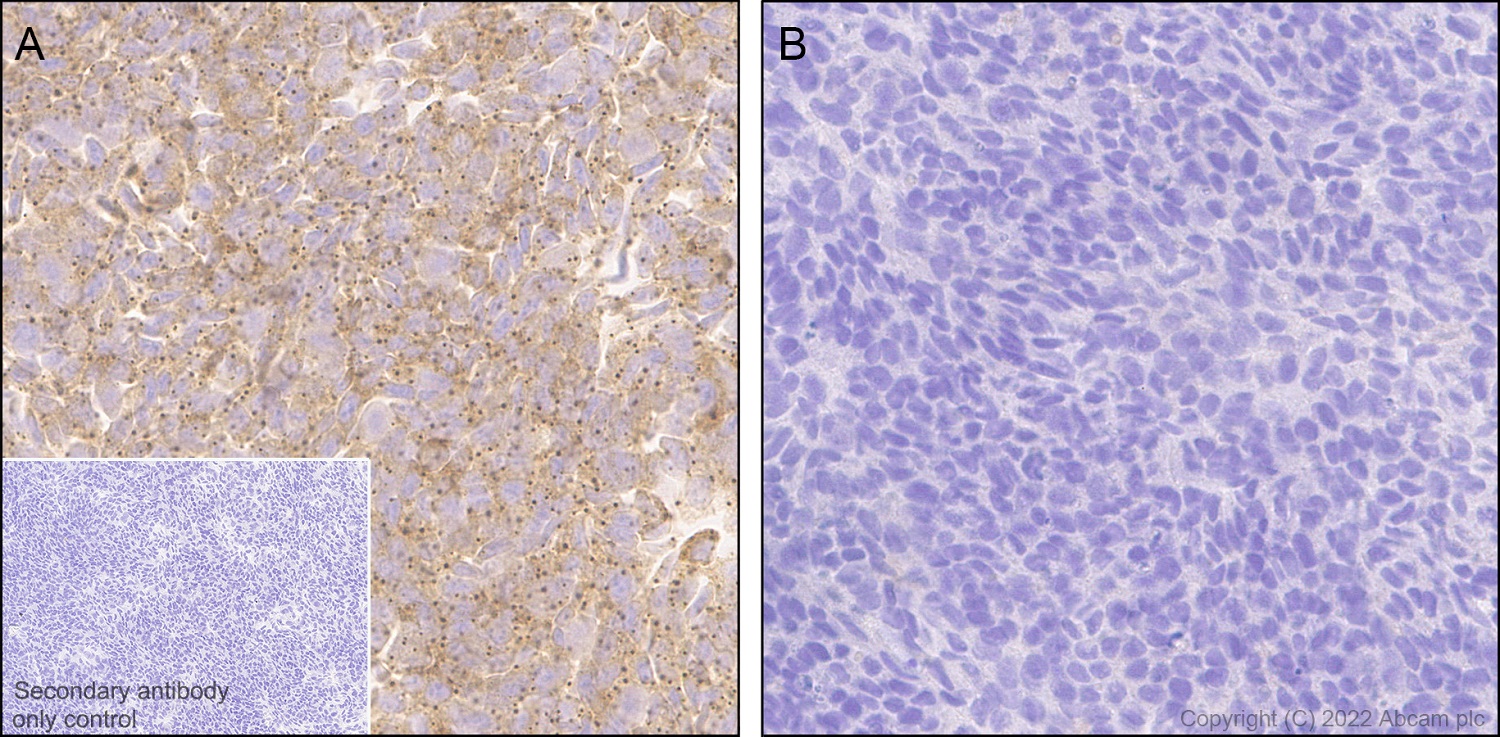 Immunohistochemistry (Formalin/PFA-fixed paraffin-embedded sections) - Anti-DDX6 antibody [EPR27016-10] (ab307418), expandable thumbnail