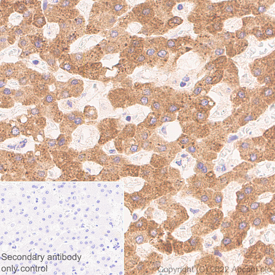 Immunohistochemistry (Formalin/PFA-fixed paraffin-embedded sections) - Anti-DDX6 antibody [EPR27016-10] (ab307418), expandable thumbnail