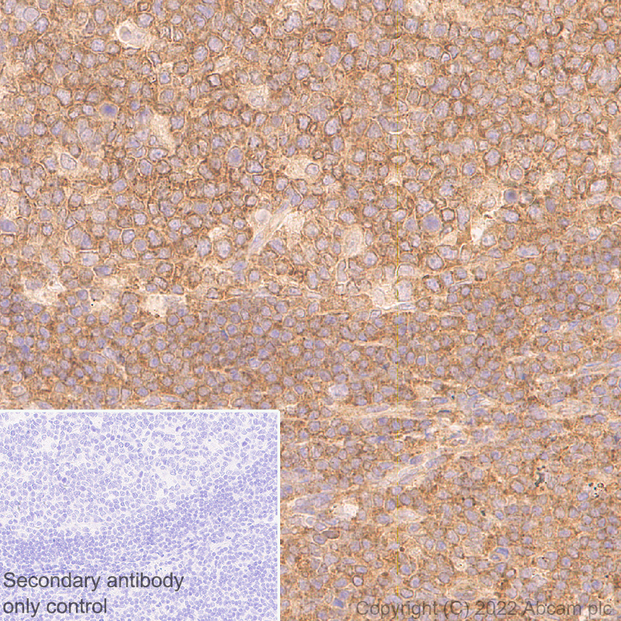 Immunohistochemistry (Formalin/PFA-fixed paraffin-embedded sections) - Anti-DDX6 antibody [EPR27016-10] (ab307418), expandable thumbnail