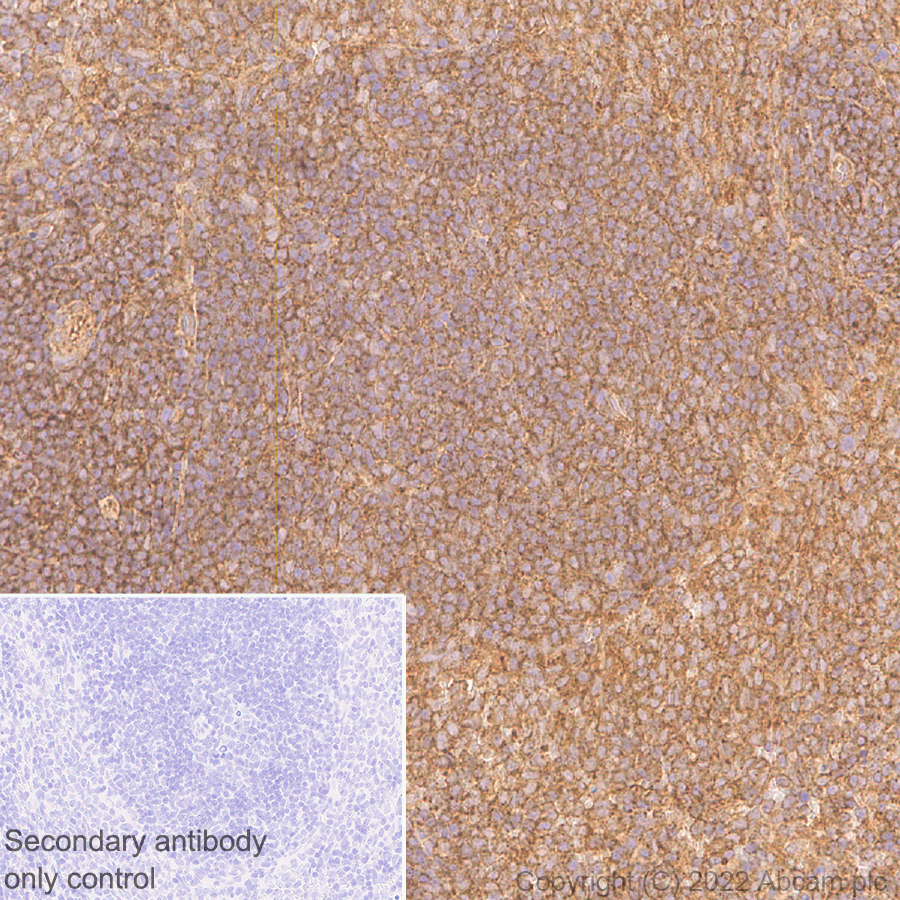 Immunohistochemistry (Formalin/PFA-fixed paraffin-embedded sections) - Anti-DDX6 antibody [EPR27016-10] (AB307418), expandable thumbnail