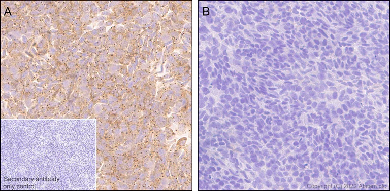 Immunohistochemistry (Formalin/PFA-fixed paraffin-embedded sections) - Anti-DDX6 antibody [EPR27016-10] - BSA and Azide free (AB307419)