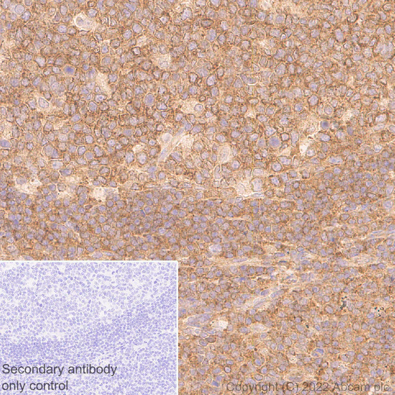 Immunohistochemistry (Formalin/PFA-fixed paraffin-embedded sections) - Anti-DDX6 antibody [EPR27016-10] - BSA and Azide free (AB307419)