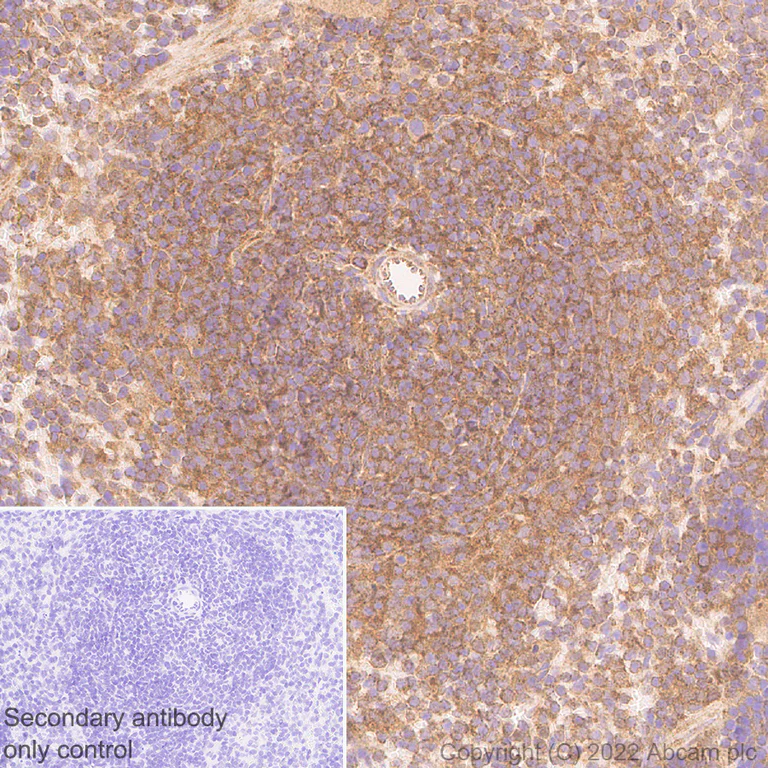 Immunohistochemistry (Formalin/PFA-fixed paraffin-embedded sections) - Anti-DDX6 antibody [EPR27016-10] - BSA and Azide free (AB307419)