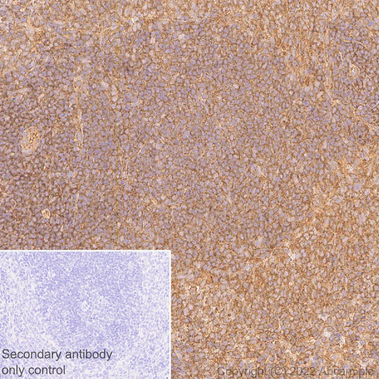 Immunohistochemistry (Formalin/PFA-fixed paraffin-embedded sections) - Anti-DDX6 antibody [EPR27016-10] - BSA and Azide free (AB307419)