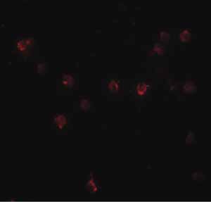Immunocytochemistry/ Immunofluorescence - Anti-DDX60 antibody (AB139807)