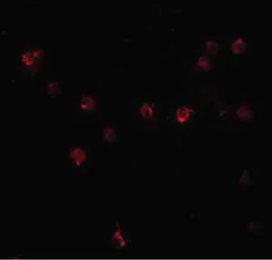 Immunocytochemistry/ Immunofluorescence - Anti-DDX60 antibody (AB139807)