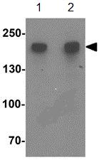 Western blot - Anti-DDX60 antibody (AB139807)