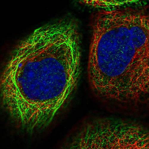 Immunocytochemistry/ Immunofluorescence - Anti-DDX60 antibody (AB151217)