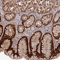 Immunohistochemistry (Formalin/PFA-fixed paraffin-embedded sections) - Anti-DDX60 antibody (AB151217)