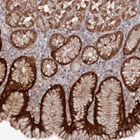 Immunohistochemistry (Formalin/PFA-fixed paraffin-embedded sections) - Anti-DDX60 antibody (AB151217)