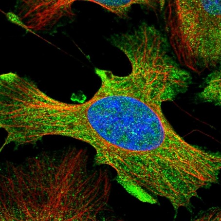 Immunocytochemistry/ Immunofluorescence - Anti-DDX60L antibody (AB220684)