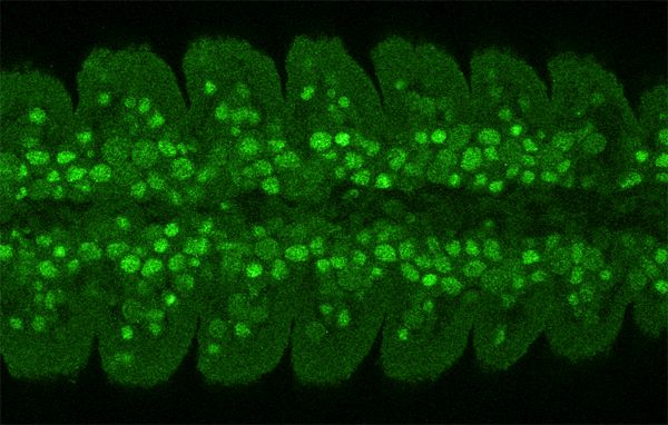 Immunohistochemistry - Anti-Deadpan antibody [11D1BC7] (AB195173), expandable thumbnail