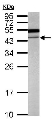 Western blot - Anti-Decorin antibody (AB137508), expandable thumbnail