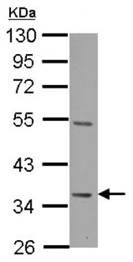 Western blot - Anti-Decorin antibody (AB137508), expandable thumbnail