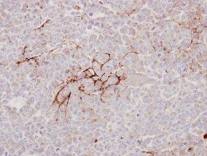 Immunohistochemistry (Formalin/PFA-fixed paraffin-embedded sections) - Anti-Decorin antibody (AB151988)