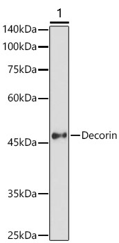 Western blot - Anti-Decorin antibody (AB175404)