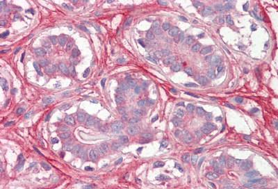 Immunohistochemistry (Formalin/PFA-fixed paraffin-embedded sections) - Anti-Decorin antibody (AB189364)