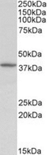 Western blot - Anti-Decorin antibody (AB189364)