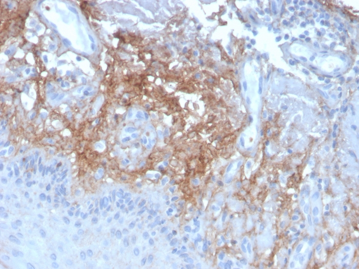 Immunohistochemistry (Formalin/PFA-fixed paraffin-embedded sections) - Anti-Decorin antibody [DCN/3523] (AB268048), expandable thumbnail