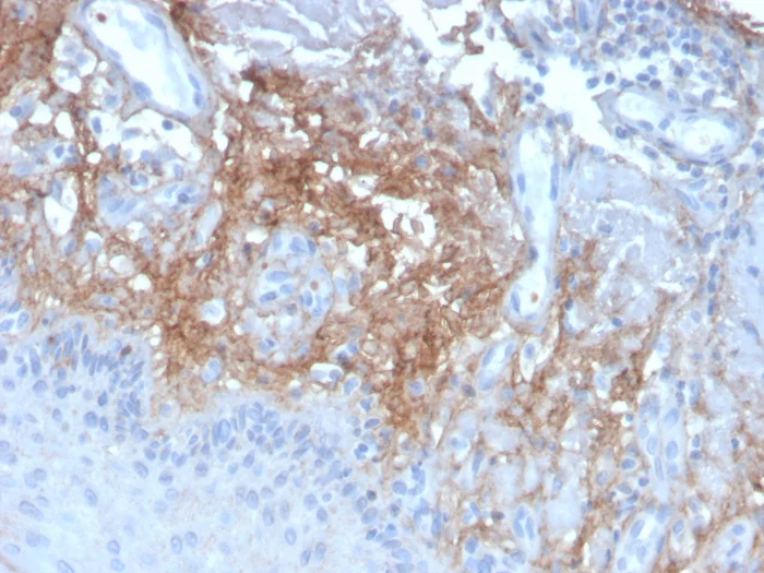 Immunohistochemistry (Formalin/PFA-fixed paraffin-embedded sections) - Anti-Decorin antibody [DCN/3523] (AB268048)
