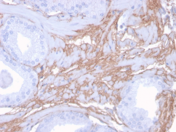 Immunohistochemistry (Formalin/PFA-fixed paraffin-embedded sections) - Anti-Decorin antibody [DCN/3523] (AB268048), expandable thumbnail