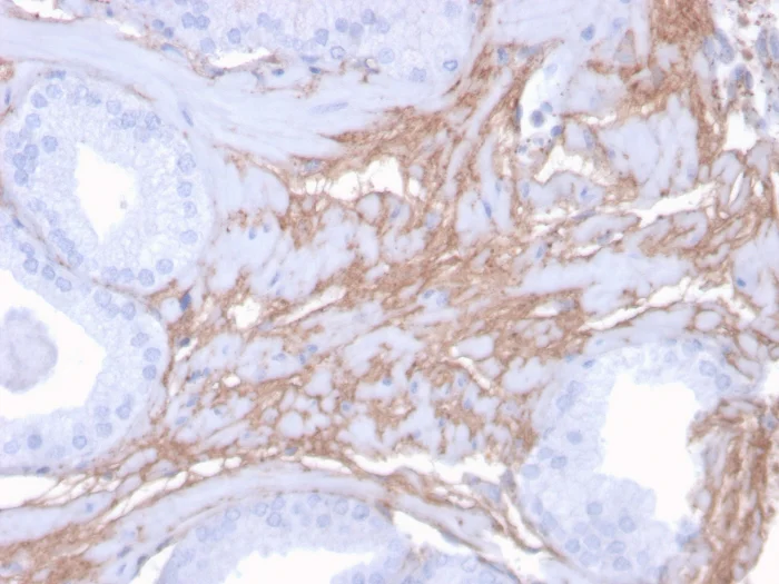 Immunohistochemistry (Formalin/PFA-fixed paraffin-embedded sections) - Anti-Decorin antibody [DCN/3523] (AB268048)