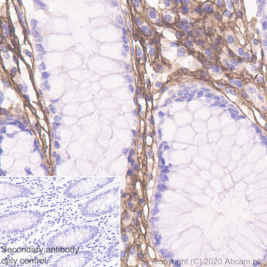 Immunohistochemistry (Formalin/PFA-fixed paraffin-embedded sections) - Anti-Decorin antibody [EPR24097-105] (AB277636), expandable thumbnail