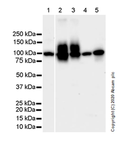 Western blot - Anti-Decorin antibody [EPR24097-105] - BSA and Azide free (AB277643)