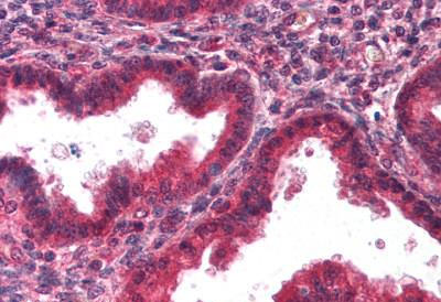 Immunohistochemistry (Formalin/PFA-fixed paraffin-embedded sections) - Anti-Decorin antibody - N-terminal (AB189071)