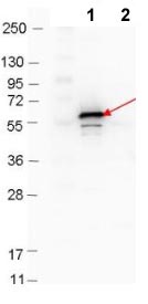 Western blot - Anti-Decorin Binding Protein B antibody (AB106608), expandable thumbnail