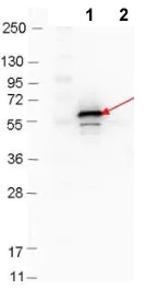 Western blot - Anti-Decorin Binding Protein B antibody (AB106608)