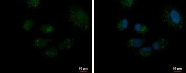 Immunocytochemistry/ Immunofluorescence - Anti-DECR2/PDCR antibody (AB153849)