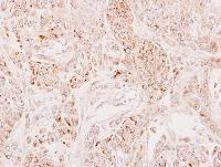 Immunohistochemistry (Formalin/PFA-fixed paraffin-embedded sections) - Anti-DECR2/PDCR antibody (AB153849)