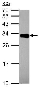 Western blot - Anti-DECR2/PDCR antibody (AB153849)