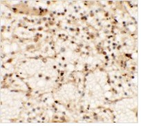 Immunohistochemistry (Formalin/PFA-fixed paraffin-embedded sections) - Anti-Dectin-1 antibody (AB140039)