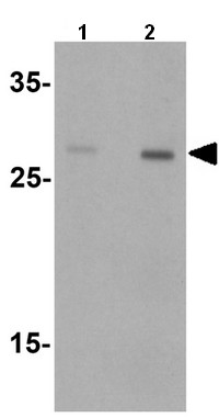 Western blot - Anti-Dectin-1 antibody (AB140039)
