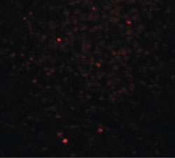 Immunohistochemistry (Formalin/PFA-fixed paraffin-embedded sections) - Anti-Dectin-1 antibody (AB189968)