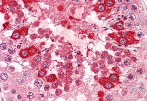 Immunohistochemistry (Formalin/PFA-fixed paraffin-embedded sections) - Anti-Dectin-1 antibody (AB189968)