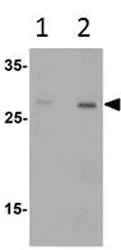 Western blot - Anti-Dectin-1 antibody (AB189968)