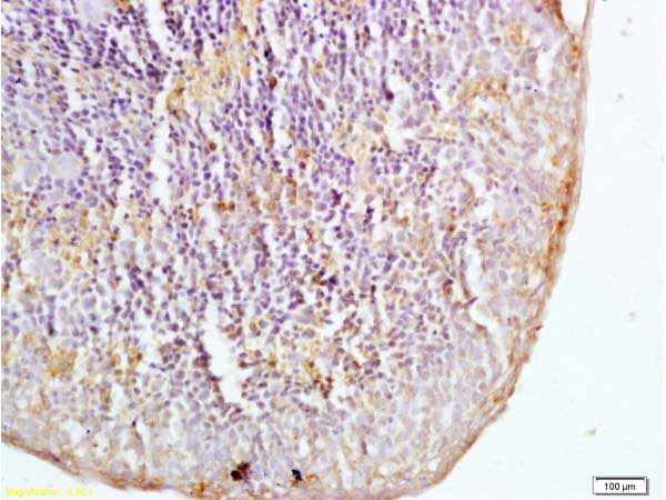 Immunohistochemistry (Formalin/PFA-fixed paraffin-embedded sections) - Anti-Dectin-1 antibody (AB217331)