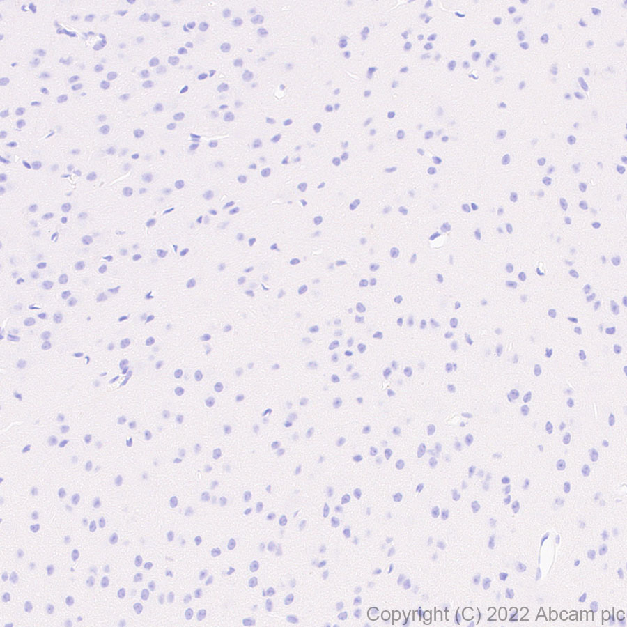 Immunohistochemistry (Formalin/PFA-fixed paraffin-embedded sections) - Anti-Dectin-1 antibody [EPR25360-19] (AB300497)