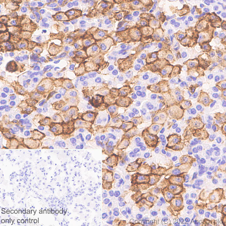 Immunohistochemistry (Formalin/PFA-fixed paraffin-embedded sections) - Anti-Dectin-1 antibody [EPR25360-19] (BSA and Azide free) (AB300498)